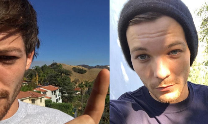 Louis Tomlinson